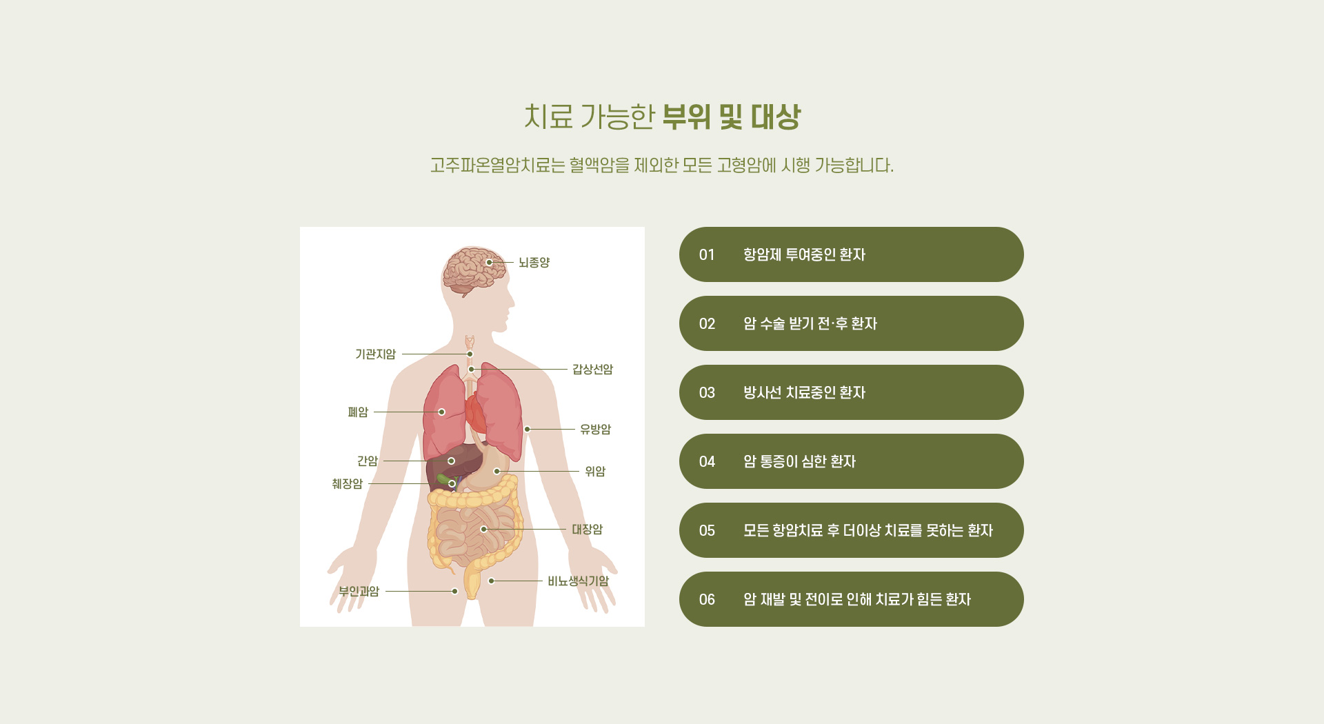 고주파온열암치료 02