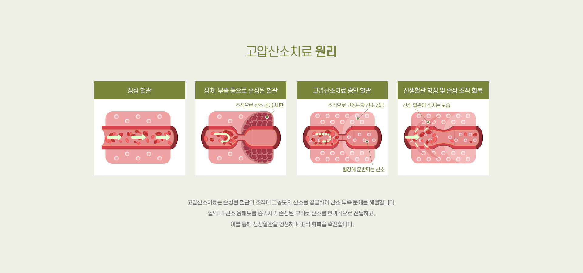 고압산소치료 02